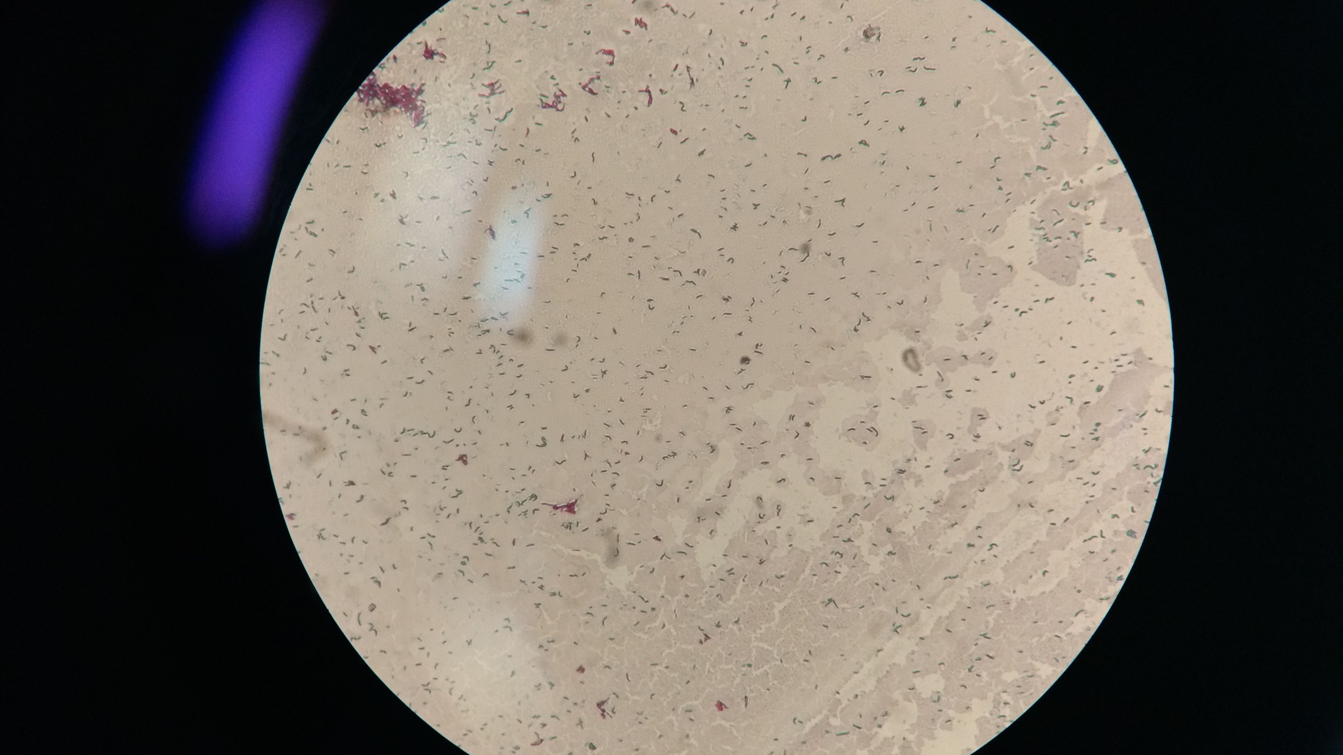 Researchers create a computer based guide to treat tuberculosis