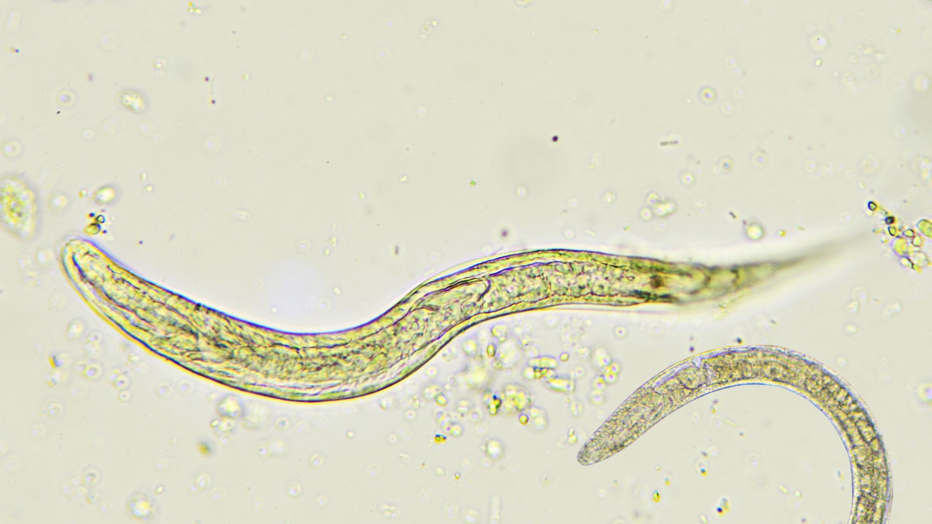 Researchers identify key brain-gut signalling pathway in roundworms