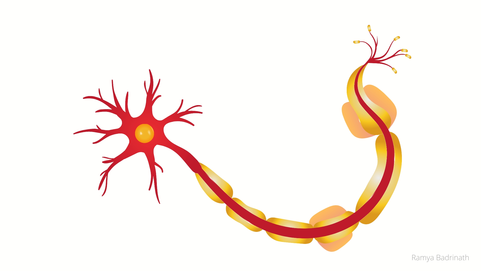 New insights into the biomechanics of axonal atrophy can aid in finding a cure to neurodegenerative conditions