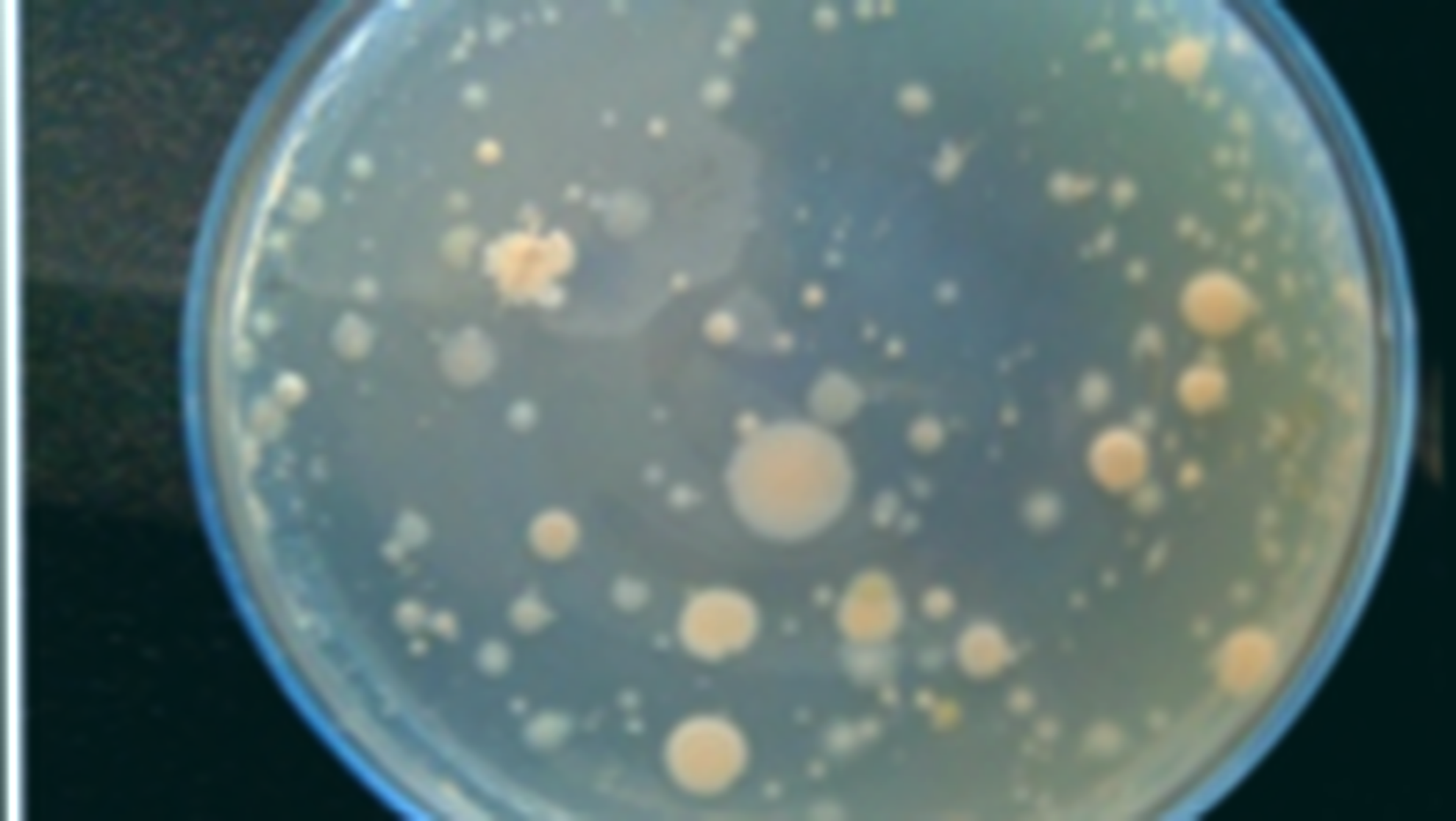 Scientists study how the mutation of a gene in bacteria contributes to drug-resistant tuberculosis