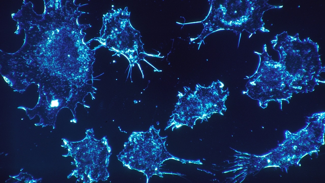 Cancer Immunotherapy: Contributions in our backyard towards this Nobel-winning research area