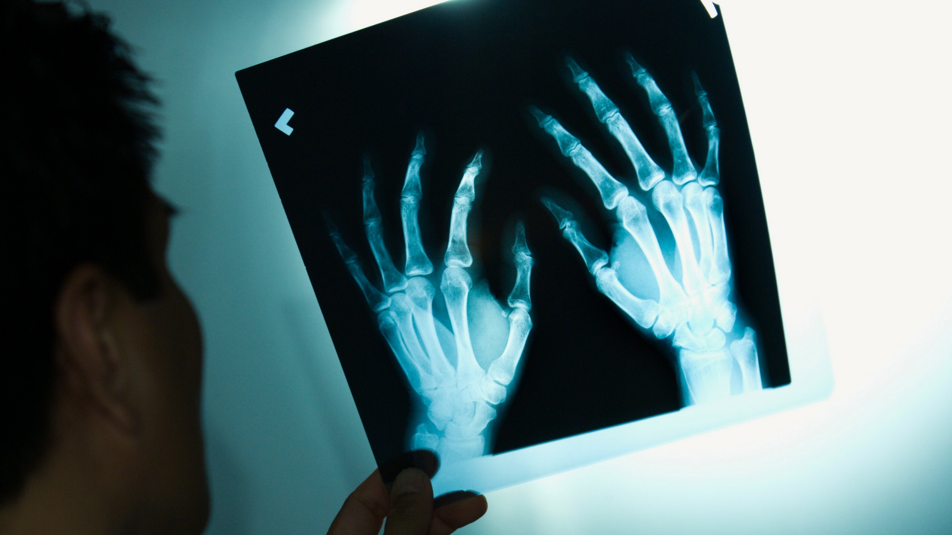 A peek at the nano-level to biomimic bones