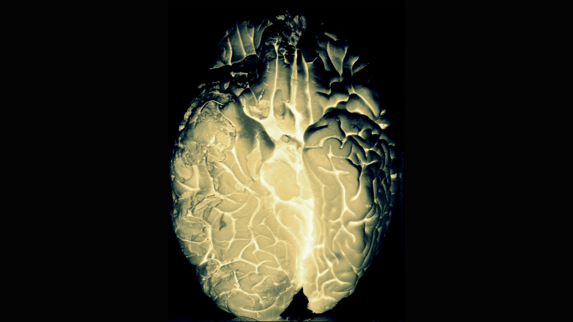 Mental maladies and the role of our immune system
