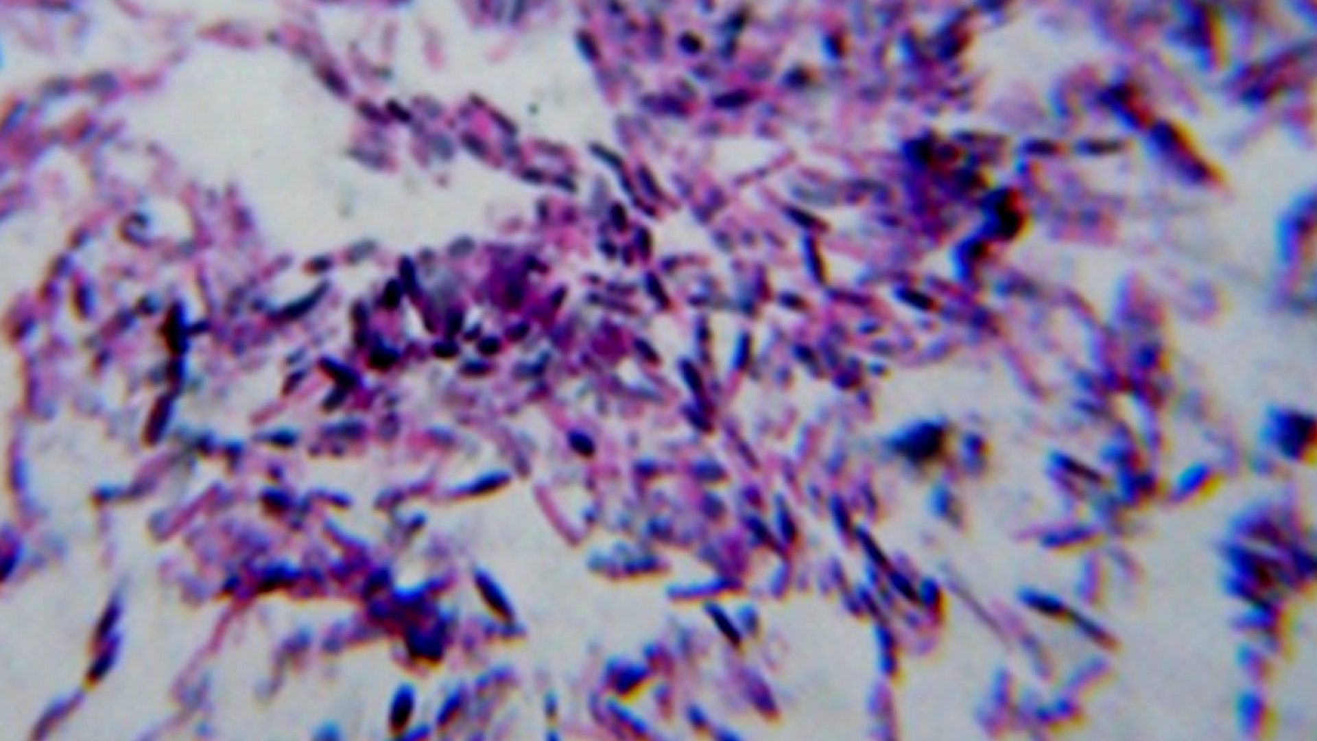 How does a bacterium move? Researchers trace its path
