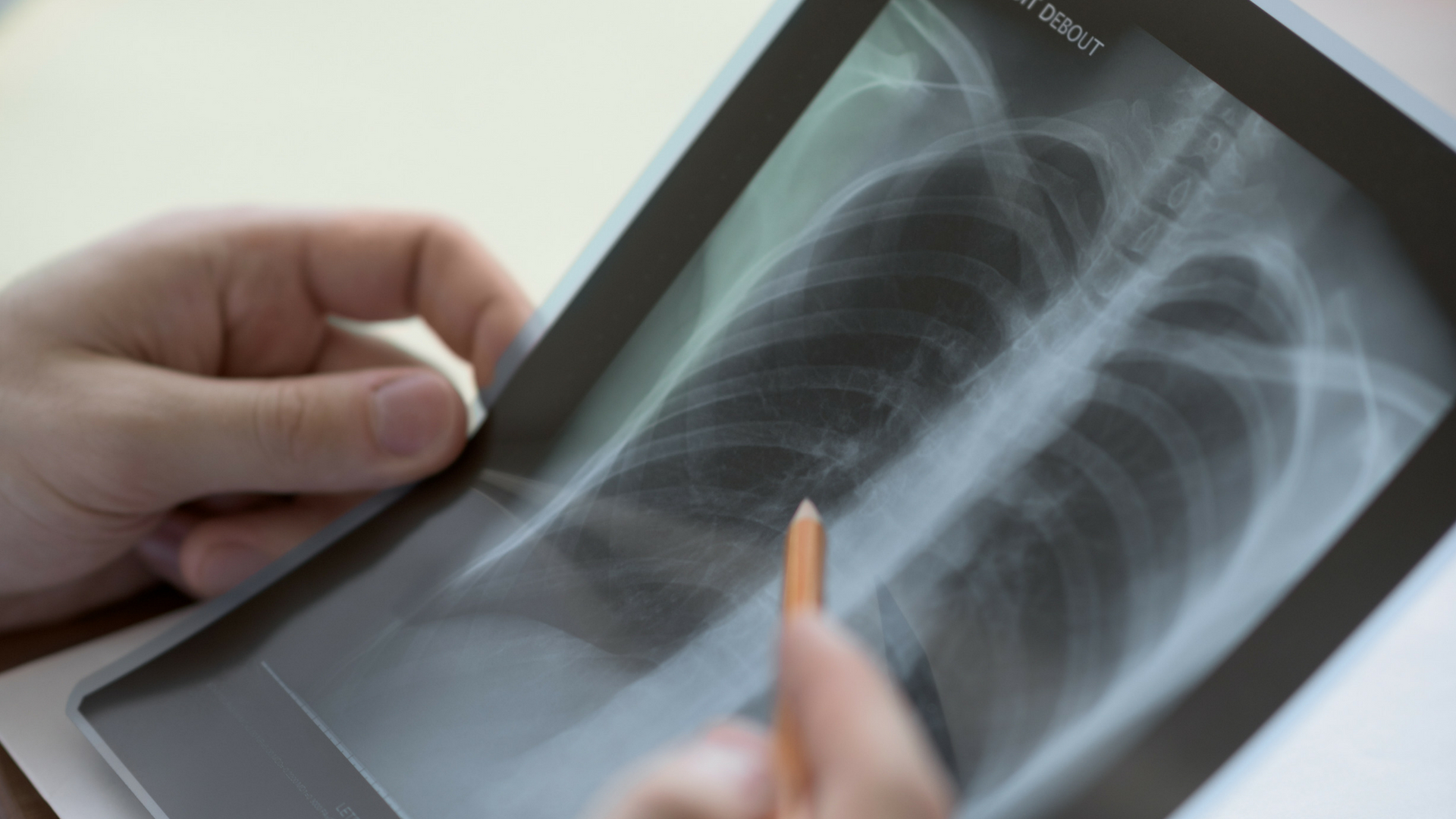 Scientists design a quicker, biosensor-based method to detect fatal fungal infection