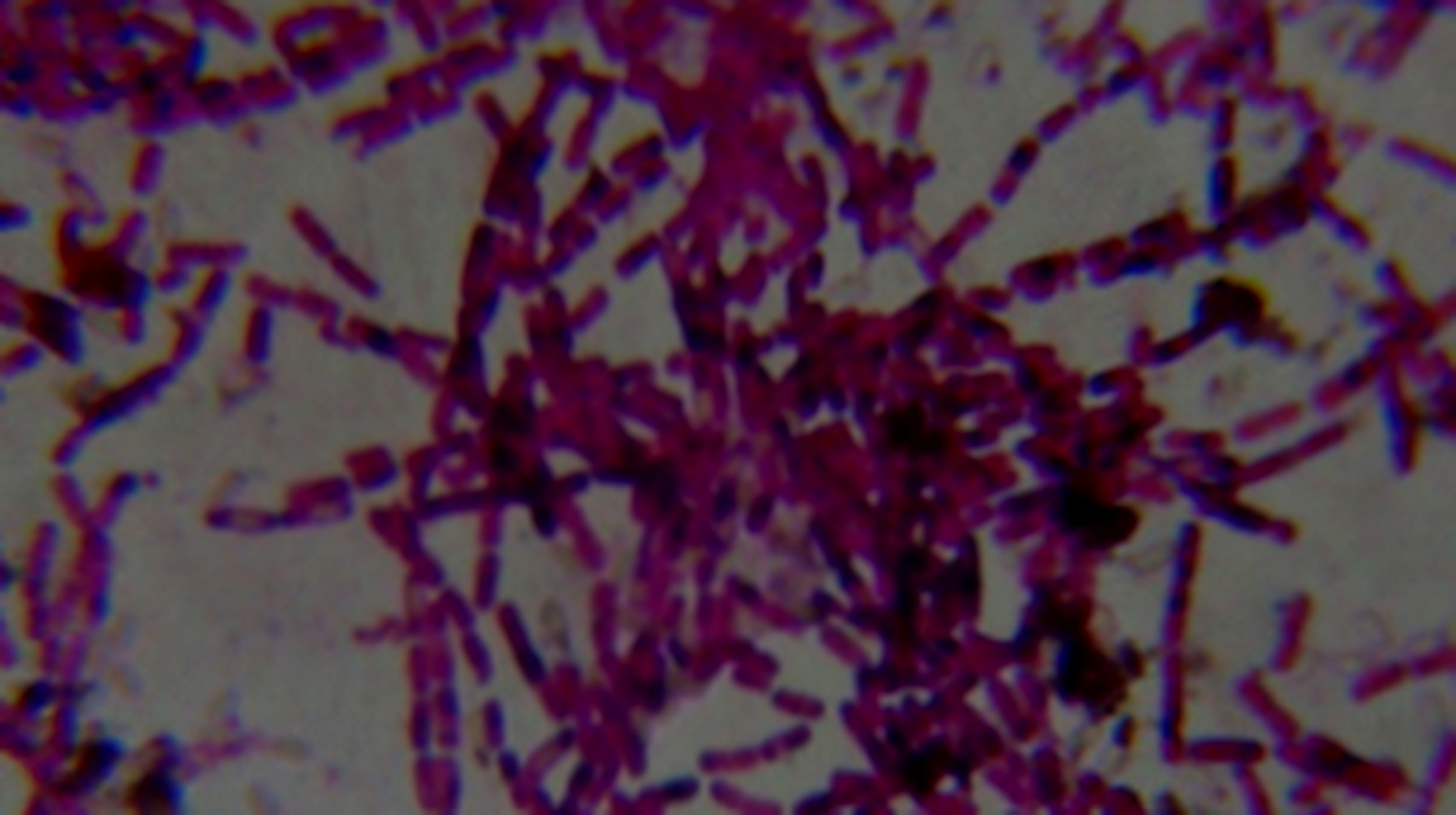 New insights into origins of riboswitches in bacteria