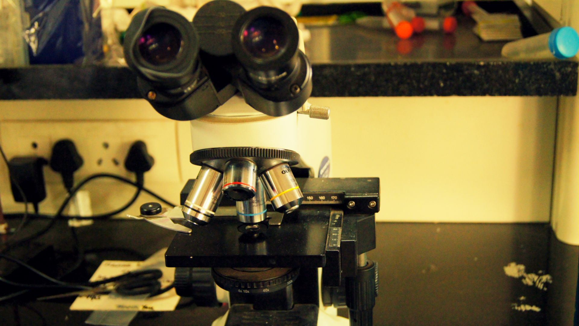 End to killer TB? Scientists identify an enzyme that may hold clue