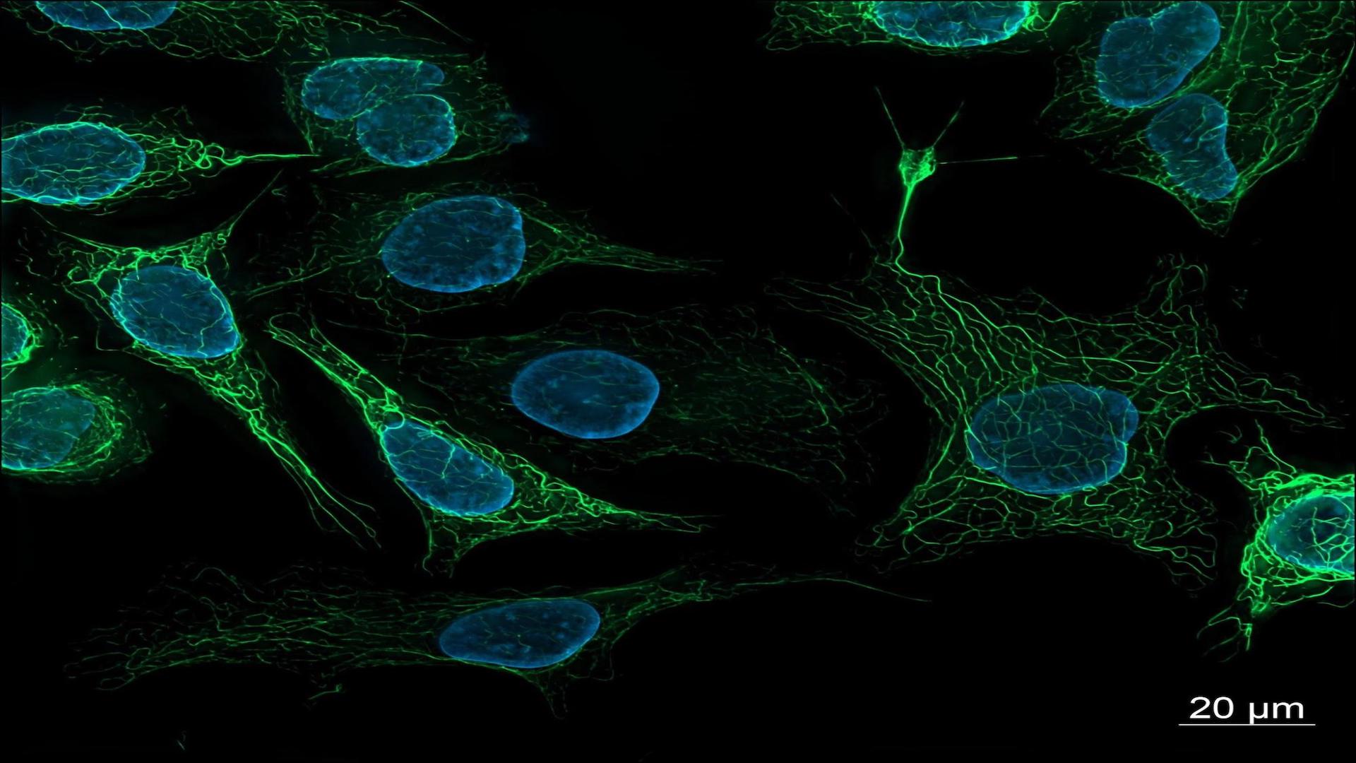 A molecular switch for feeding and fasting could hold clue to obesity and aging