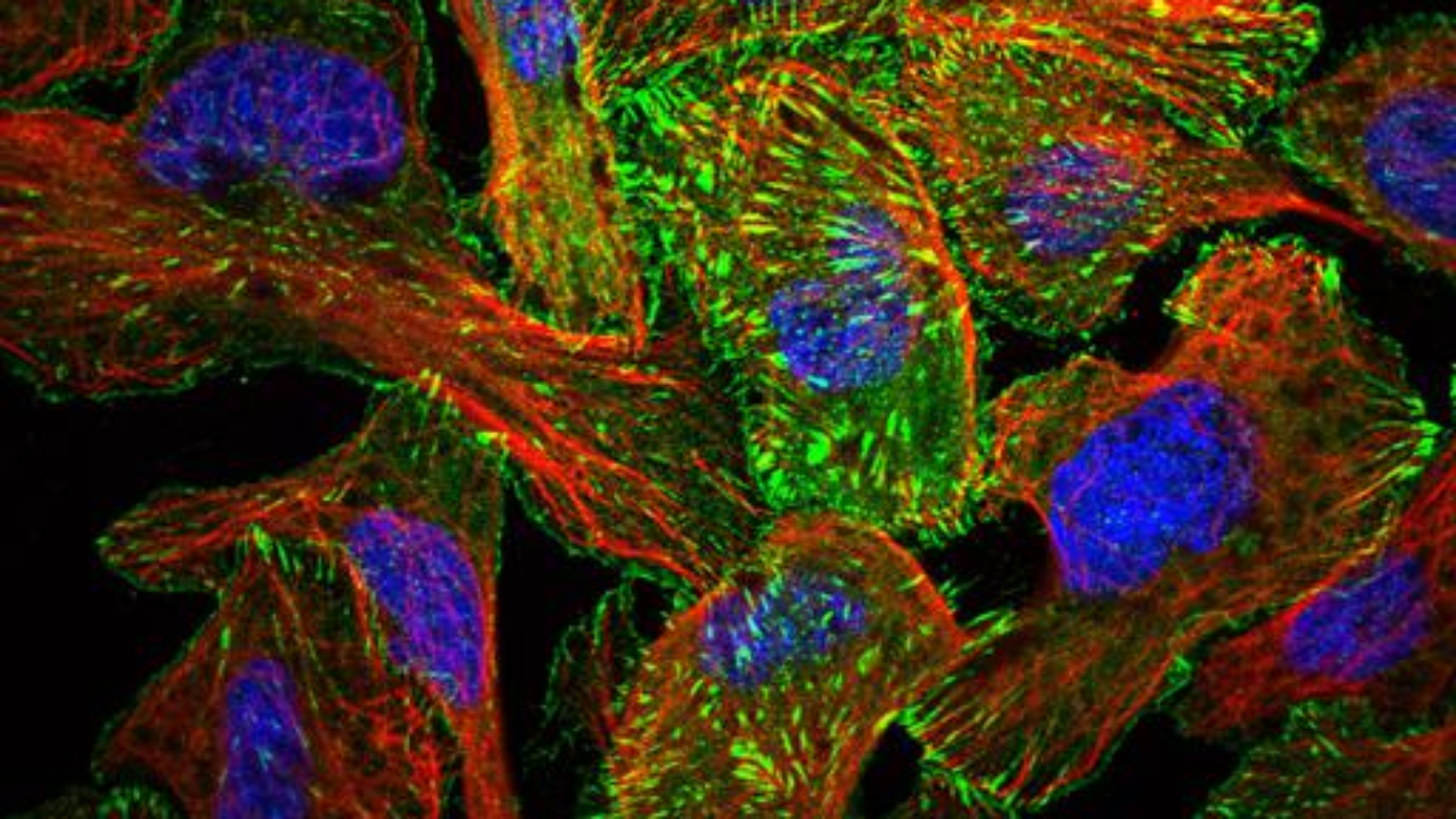 A protein puppet show: Scientists show how cortex proteins pull strings to control cell surface functions