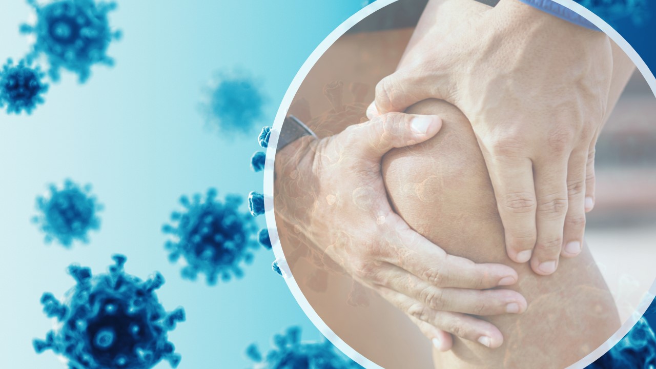 The emerging association between COVID-19 and Rheumatoid Arthritis
